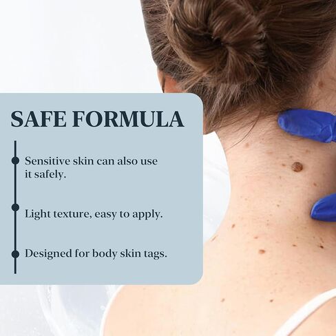 Skin Mole Remover for Hands & Body - Fast Acting Wart Removal with Precision Applicator, Skin Tag Remover for Corns, Mole, Plantar & Common Warts, for Body and Hands(0.33 FL.OZ) in Kuwait