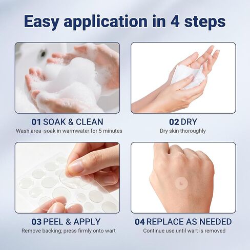 Komxsum Wart Remover Patches, Removes Warts from Various Parts of The Body,Fast Acting,Safe and Easy to Use(180PCS) in Kuwait
