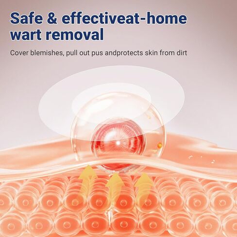 Komxsum Wart Remover Patches, Removes Warts from Various Parts of The Body,Fast Acting,Safe and Easy to Use(180PCS) in Kuwait
