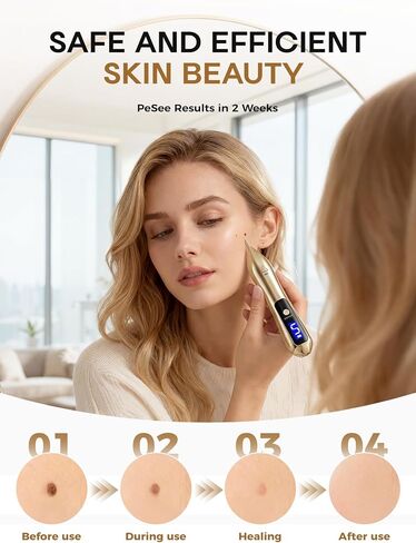 قلم إزالة علامات الجلد بـ 9 سرعات - أداة إزالة ثآليل الشامات القابلة لإعادة الشحن عبر USB، شاشة LCD وقفل أمان، مزيل البقع الاحترافي غير المؤلم للاستخدام المنزلي للوجه والجسم in Kuwait