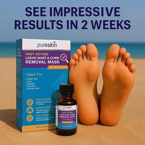 PURESKIN Plantar Wart Corn Remover for Feet: 17% Salicylic Acid Wart Corn Removal Treatment for Corn, Plantar Wart, Common Wart & Flat Wart on Toes, Fingers, feet and Hand - 0.5 Fl Oz (Pack of 1) in Kuwait