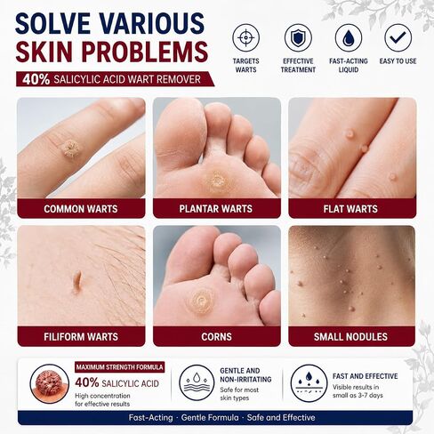 40% Salicylic Acid Wart Remover Liquid for Feet & Body, Maximum Strength Plantar Wart Remover for Feet, Fast-Acting Wart Remover for Common, Flat & Foot Warts, Easy-to-Use Wart Remover Liquid in Kuwait