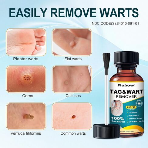 Fast-Acting Skin Tag Remover for Body and Neck - Natural Skin & Wart Freeze Off Treatment for Women and Men, Effective Removal for Plantar, Flat, Common, Corn and Hand Warts, 30 ML in Saudi Arabia