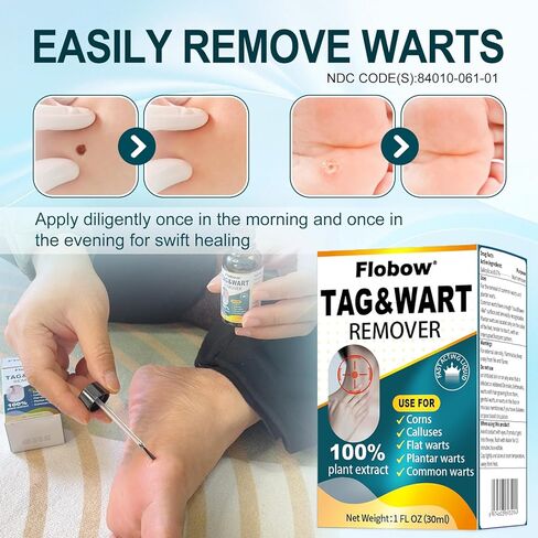 Fast-Acting Skin Tag Remover for Body and Neck - Natural Skin & Wart Freeze Off Treatment for Women and Men, Effective Removal for Plantar, Flat, Common, Corn and Hand Warts, 30 ML in Saudi Arabia