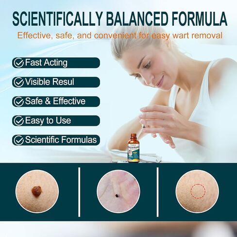 Fast-Acting Skin Tag Remover for Body and Neck - Natural Skin & Wart Freeze Off Treatment for Women and Men, Effective Removal for Plantar, Flat, Common, Corn and Hand Warts, 30 ML in Saudi Arabia