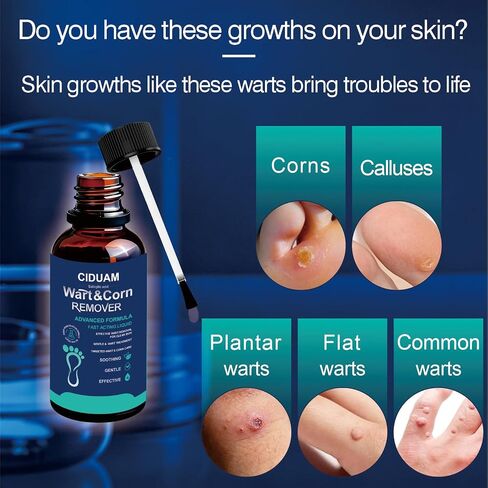 Skin Tag Remover, Wart Remover Freeze Off, Fast-Acting Wart & Skin Tag Removal, with Salicylic Acid Maximum Strength, Gentle and Painless, Easy Action, Safe for Sensitive Skin in Saudi Arabia