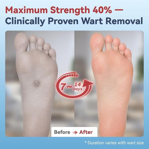 40% Salicylic Acid Wart Remover Pads — Maximum-Strength OTC, Fast-Acting Effectively Removes for Common Warts and Plantar Warts and Periungual Warts, 14 Pads (Dual-Size) and 14 Waterproof PU Films in Kuwait