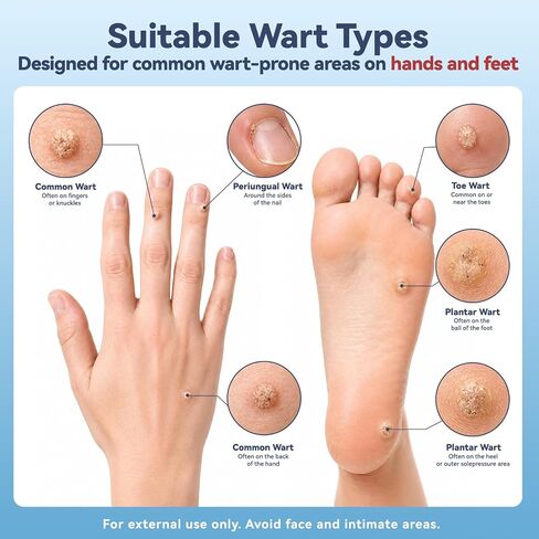 40% Salicylic Acid Wart Remover Pads — Maximum-Strength OTC, Fast-Acting Effectively Removes for Common Warts and Plantar Warts and Periungual Warts, 14 Pads (Dual-Size) and 14 Waterproof PU Films in Kuwait