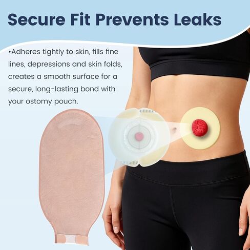 50 PCS 4mm Ostomy Barrier Rings, Medical Hydrocolloid Colostomy Supplies, Moldable Barrier Rings for Ostomy Bag, Suitable for Colostomy, Ileostomy and Urostomy, Skin-Friendly, Leak-Proof Seal in Saudi Arabia