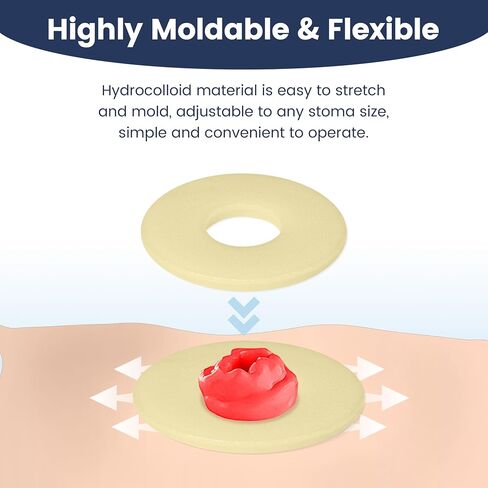 50 PCS 4mm Ostomy Barrier Rings, Medical Hydrocolloid Colostomy Supplies, Moldable Barrier Rings for Ostomy Bag, Suitable for Colostomy, Ileostomy and Urostomy, Skin-Friendly, Leak-Proof Seal in Saudi Arabia