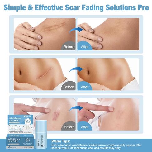 Silicone Scar Stick, 80% Silicone Stick for Face and Body. Silicone Stick for Removal of Surgical,Old and Recent Scars and Stretch Marks - 7g in Kuwait