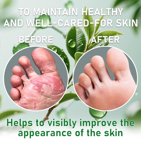 2PCS Foot Spray with Tea Tree Oil,Tea Tree Oil Feet Spray,Foot & Shoe Freshness,Quick-Drying and Travel in Saudi Arabia