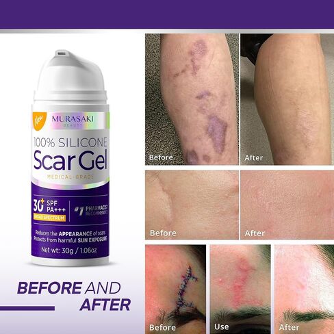 Silicone Scar Gel Scar Cream: SPF 30 Advanced Medical-Grade Formula for Surgical Scars, C-Section, Stretch Marks, Acne, Burns, Keloids, Old & New Scars – Broad Spectrum UV Protection 1.06oz (30g) in Saudi Arabia
