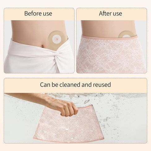 DERAYMI Ostomy Support Garments, Ostomy Wrap Colostomy Bag Covers, Hernia Ostomy Belt for Women Ostomy, Illeostomy, Colostomy, illeostomy, Urostomy Bag Covers (Nude Colored Lace, Large) in Kuwait
