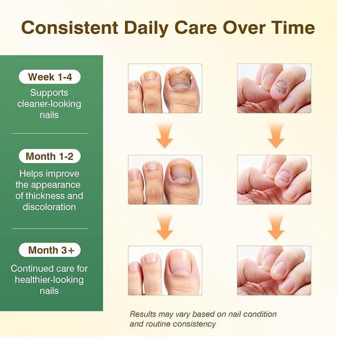 Toenail Fungus Treatment ExtraStrength - Nail Repair for DamagedNails, Nail Repair with 25% UndecylenicAcid & Tolnaftate, Toenail FungusTreatment for Fungal ToenailFingernails & Athletes Foot 3PCS in Saudi Arabia