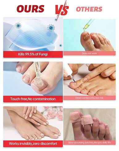 Toenail Fungus Treatment Extra Strength - 25% Undecylenic Acid, Gentle Plant-Based Formula for Damaged & Discolored Nails, Effective Treatment Under & Around Nails, Suitable, 1.01Fl. oz in Kuwait