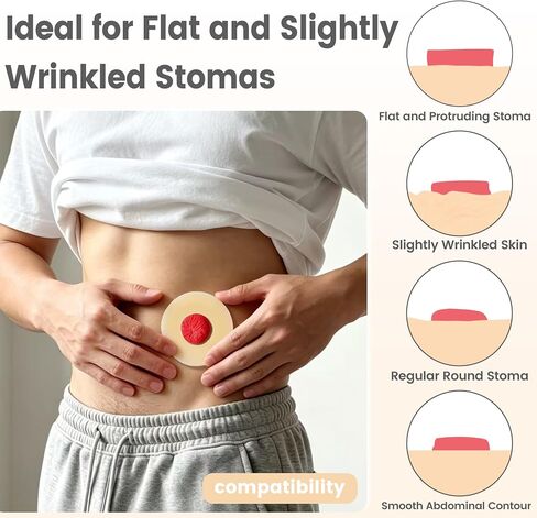 50 PCS 2mm Ostomy Barrier Rings, Medical Hydrocolloid Colostomy Supplies, Moldable Barrier Rings for Ostomy Bag, Suitable for Colostomy, Ileostomy and Urostomy, Skin-Friendly, Leak-Proof Seal in Saudi Arabia