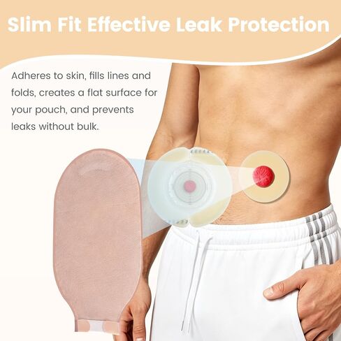 50 PCS 2mm Ostomy Barrier Rings, Medical Hydrocolloid Colostomy Supplies, Moldable Barrier Rings for Ostomy Bag, Suitable for Colostomy, Ileostomy and Urostomy, Skin-Friendly, Leak-Proof Seal in Saudi Arabia