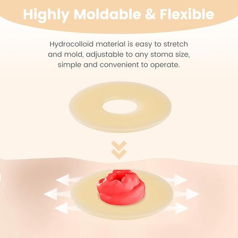 50 PCS 2mm Ostomy Barrier Rings, Medical Hydrocolloid Colostomy Supplies, Moldable Barrier Rings for Ostomy Bag, Suitable for Colostomy, Ileostomy and Urostomy, Skin-Friendly, Leak-Proof Seal in Saudi Arabia