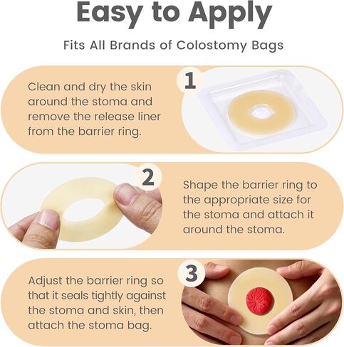 50 PCS 2mm Ostomy Barrier Rings, Medical Hydrocolloid Colostomy Supplies, Moldable Barrier Rings for Ostomy Bag, Suitable for Colostomy, Ileostomy and Urostomy, Skin-Friendly, Leak-Proof Seal in Saudi Arabia