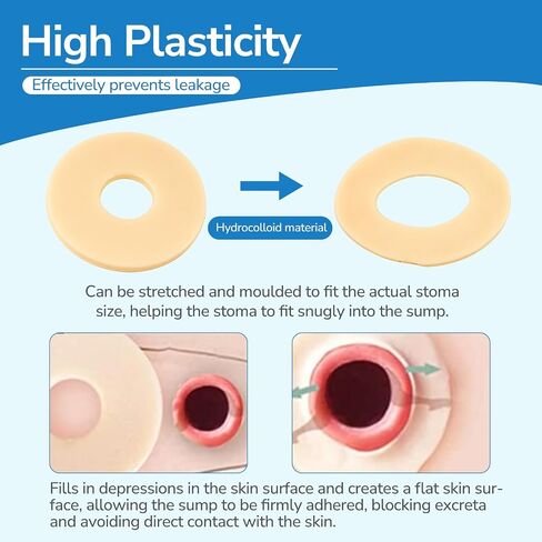 10 PCS Ostomy Barrier Rings, Ostomy Supplies, 2 mm Thickness Moldable Ostomy Rings Medical Grade Hydrocolloid Adhesive Barrier Rings Better Seal for Ostomy Bags (Box of 10) in Kuwait