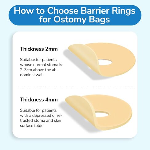 10 PCS Ostomy Barrier Rings, Ostomy Supplies, 2 mm Thickness Moldable Ostomy Rings Medical Grade Hydrocolloid Adhesive Barrier Rings Better Seal for Ostomy Bags (Box of 10) in Kuwait