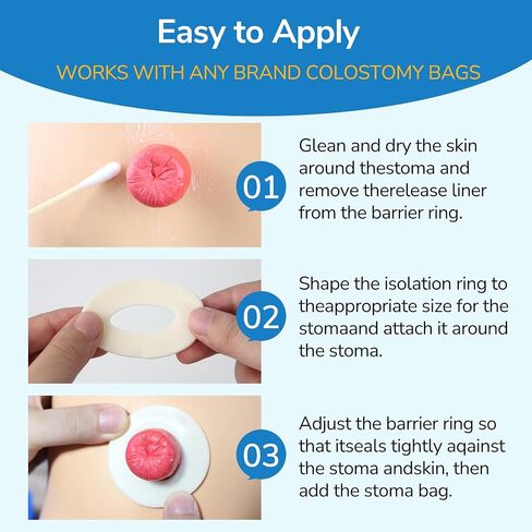 10 PCS Ostomy Barrier Rings, Ostomy Supplies, 2 mm Thickness Moldable Ostomy Rings Medical Grade Hydrocolloid Adhesive Barrier Rings Better Seal for Ostomy Bags (Box of 10) in Kuwait