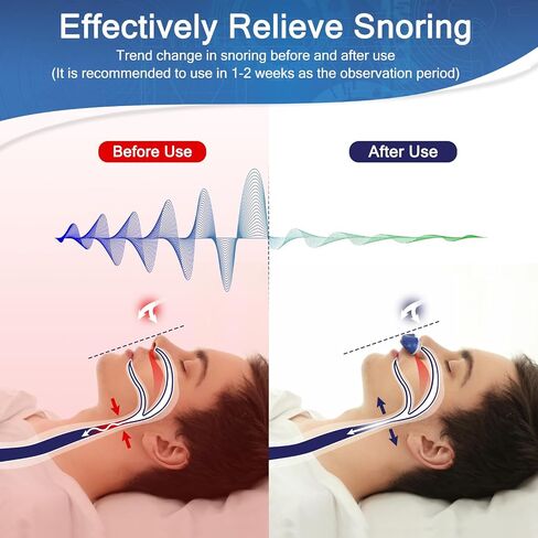 Anti Snore Device,Stop Snoring Reduction,Electric Anti Snoring Devices,Adjustable Airflow Snoring Solution Aids for Men & Women(Blue) in Saudi Arabia