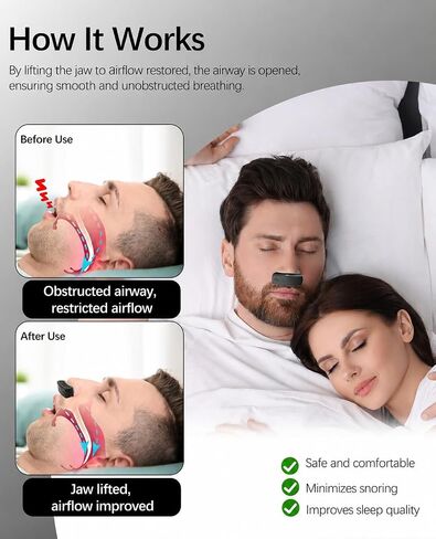 Anti Snoring Devices, Electric Snoring Solution with Adjustable Security Strap, Adjustable 6-Speed, Universal Fit for All Nose Shapes for Men & Women (Matte Black) in Saudi Arabia