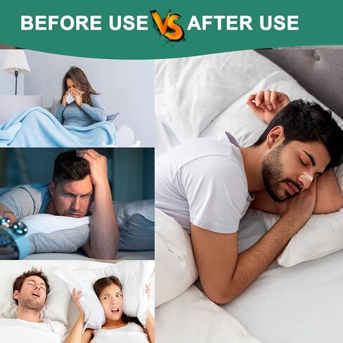 Nasal Strips for Snoring, 120 Count Extra Strength Nose Strips for Breathing, Sleep Snore Strips for Men Women, Relieve Nasal Congestion Due to Colds & Allergies, Anti Snoring - Tan in Kuwait