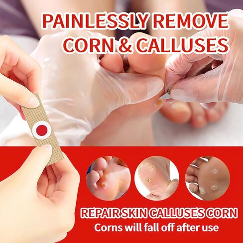 Corn and Callus Remover for Toes and Feet - Extra Strength 40% Salicylic Acid Nursing Pads-Formulated With a Safe Formula to Effectively Remove Corns and Calluses（42 Pack） in Kuwait
