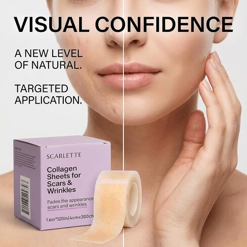 Scarlette Collagen Tape, Collagen Sheets For Scars & Wrinkle, Scar Silicone Sheets For Various Different Scars, Surgical,C-Section,Tummy Tuck, 1.6"x 120" Roll (1PCS) in Kuwait