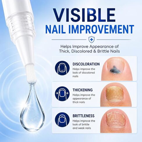 Nail Fungus Treatment Extra Strength: 25% Undecylenic Acid Formula - Toenail Fungus Treatment Kit with 5 Pens & Nail File for Ingrown Nails, Discoloration & Brittle Nails in Saudi Arabia