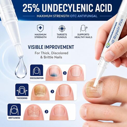 Nail Fungus Treatment Extra Strength: 25% Undecylenic Acid Formula - Toenail Fungus Treatment Kit with 5 Pens & Nail File for Ingrown Nails, Discoloration & Brittle Nails in Saudi Arabia