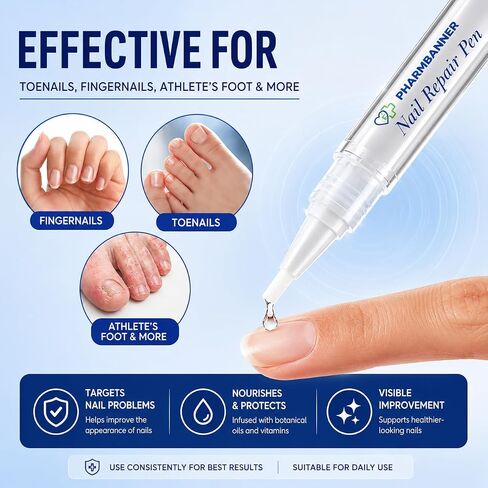 Nail Fungus Treatment Extra Strength: 25% Undecylenic Acid Formula - Toenail Fungus Treatment Kit with 5 Pens & Nail File for Ingrown Nails, Discoloration & Brittle Nails in Saudi Arabia