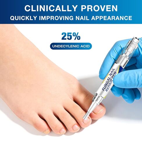 Toenail Fungus Treatment Extra Strength - AntiFung Pen - Maximum OTC with 25% Undecylenic Acid - for Damaged Nails, Ingrown Nails & Discoloration - 3-Pack Applicator Pen in Saudi Arabia