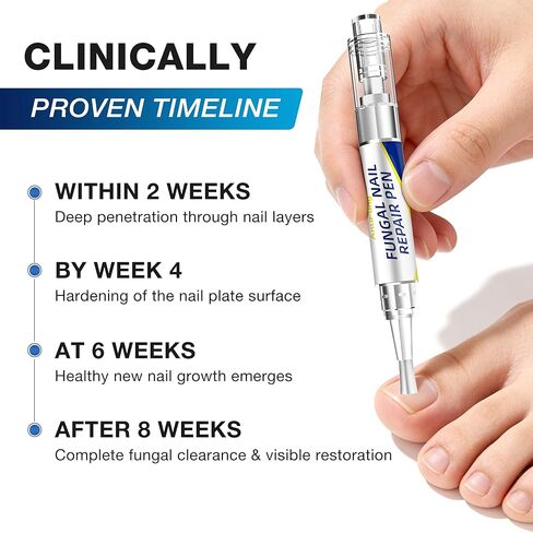 Toenail Fungus Treatment Extra Strength - AntiFung Pen - Maximum OTC with 25% Undecylenic Acid - for Damaged Nails, Ingrown Nails & Discoloration - 3-Pack Applicator Pen in Saudi Arabia