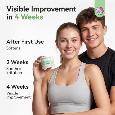 SAVILAND Antifungal Cream FSA-HSA Max Strength: 25% Undecylenic Acid Anti Fungal Cream for Skin Athletes Foot Jock Itch Ringworm Foot Fungus Treatment Comfort with Tea Tree & Oregano Oil 4.23 oz in Kuwait