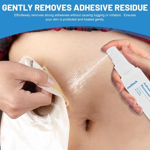 Adhesive Remover Spray, Medical Skin Adhesive Remover, No Sting, Alcohol Free, Colostomy Ostomy Supplies for Stoma Care, Ostomy Patients, Bandage Removal, 1 oz (30ml) in Saudi Arabia