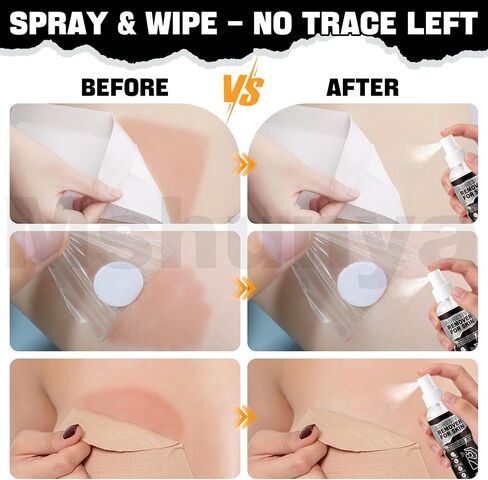 4.06 Oz Medical Adhesive Remover, Skin Adhesive Remover, Adhesive Remover for Skin, Gentle and Non-irritating, Quick-Peeling for Silicone Adhesive, Bandage, Tape and Ostomy Residue in Saudi Arabia