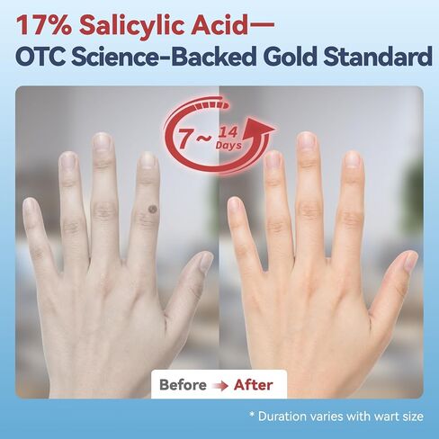 17% Salicylic Acid Wart Remover – Gentle OTC with Natural Plant Extracts, Fast-Acting Effectively Removes for Common Warts and Plantar Warts with Precision applicator & 12 Waterproof Patches in Kuwait