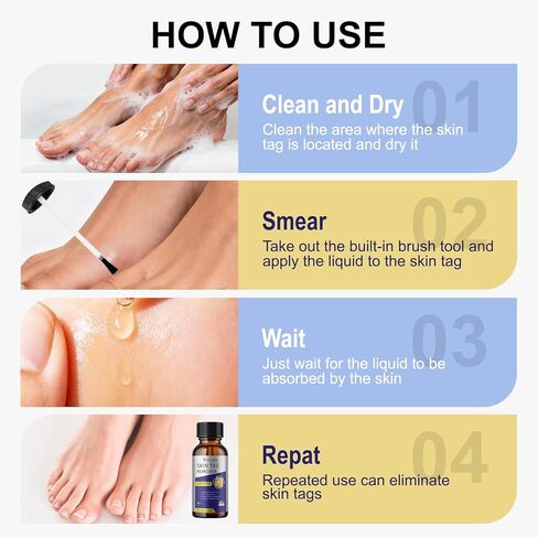 Fast-Acting Skin Tag Remover with Salicylic Acid, with a Precision Brush, Natural & Advanced Formula, Mild & Non irritating, Suitable for All Skin Types, Efficiently & Painless Remover Tags, 30ml in Saudi Arabia