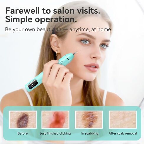 Skintag Remover for At-Home Use, Designed for Gentle Removal and Everyday Personal Care - Skin Clinic Point for Warts and Skin Tags - TFN-A02 in Saudi Arabia