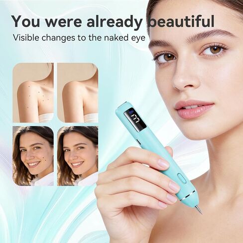 Skintag Remover for At-Home Use, Designed for Gentle Removal and Everyday Personal Care - Skin Clinic Point for Warts and Skin Tags - TFN-A02 in Saudi Arabia