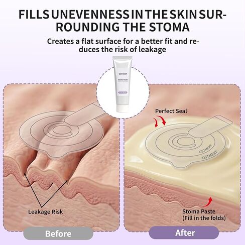 Ostomy Paste for Leak Prevention - Ostomy Supplies - Alcohol-Free Stoma Paste for Skin Barrier Seal & Protection - 2oz Tube in Kuwait