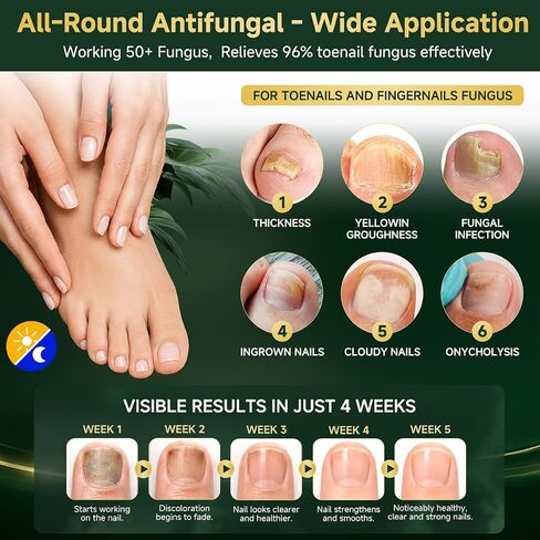 2026 Upgrade Toenail Fungus Treatment Pen,Extra Strength 25% Undecylenic Acid【GMP Certified - 7X Deep Penetration】 Nail Repair Patches Tea Tree Oil for Toenails Fingernails 6 Pens Day & Night in Kuwait