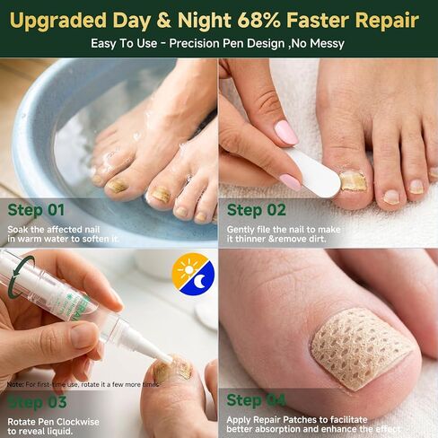 2026 Upgrade Toenail Fungus Treatment Pen,Extra Strength 25% Undecylenic Acid【GMP Certified - 7X Deep Penetration】 Nail Repair Patches Tea Tree Oil for Toenails Fingernails 6 Pens Day & Night in Kuwait