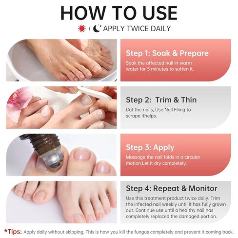 Nail Fungus Treatment Extra Strength – 1% Tolnaftate, Effective Treatment Under and Around Nails, Repairs Damaged Nails, Plant-Based Gentle Formula for Thickened and Discolored Nails, 0.51 fl.oz in Kuwait