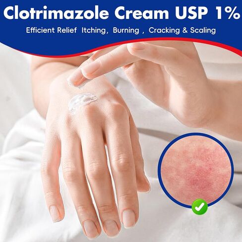 Clotrimazole Antifungal Cream 1% USP (1 oz), Anti Fungal Treatment, Relieves Itching, Burning, Cracking and Scaling Associated Athletes Foot in Saudi Arabia