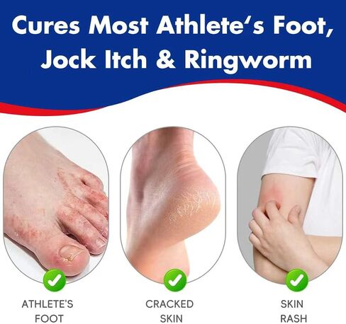 Clotrimazole Antifungal Cream 1% USP (1 oz), Anti Fungal Treatment, Relieves Itching, Burning, Cracking and Scaling Associated Athletes Foot in Saudi Arabia